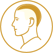 Illustration of Advanced Hair Loss